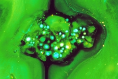 Photosynthese